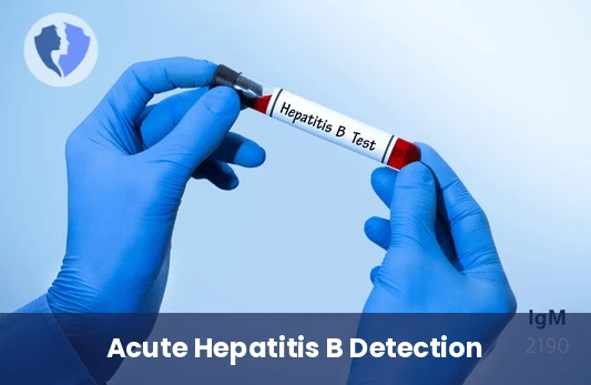 Hepatitis B Core IgM Test - Hepatitis B Core (HBc) IgM Antibodies Test
