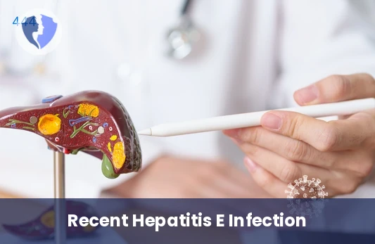 Early Hepatitis E Detection - Hepatitis E Virus IgM Antibody Test