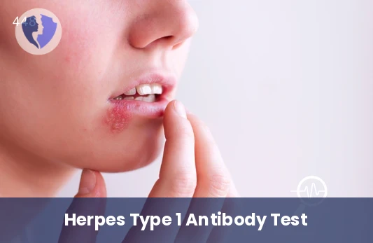 HSV-1 Immunity Test - Herpes Simplex Virus Type 1 (HSV-1) IgG Antibody Test