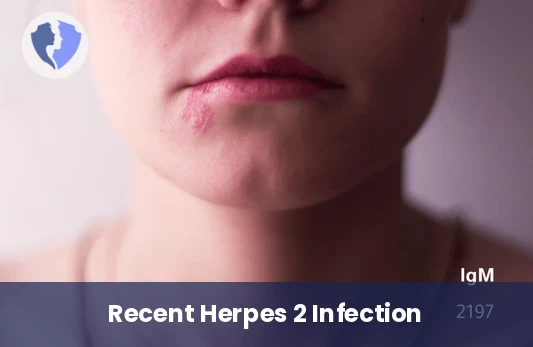 Herpes Type 2 IgM Test - Herpes Simplex Virus Type 2 (HSV-2) IgM Test
