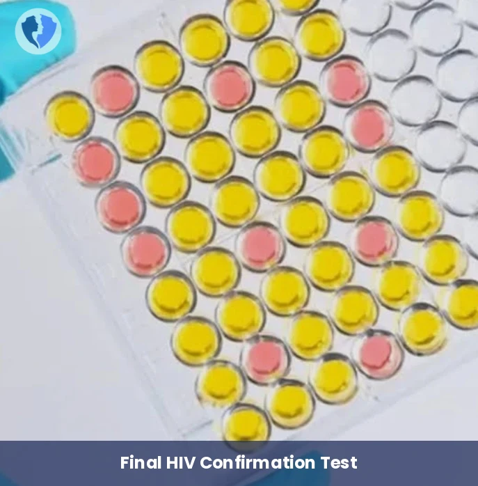 HIV Confirmatory Test - HIV Western Blot Confirmatory Test