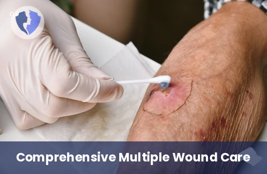 Large and Multiple Wound Care - Home Care for Large and Multiple Wounds