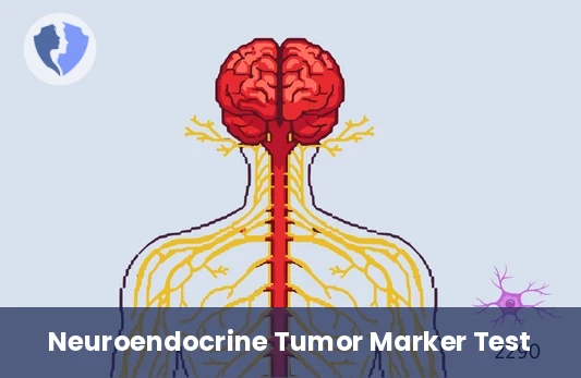 HVA Urine Test - Homovanillic Acid (HVA) Urine Test