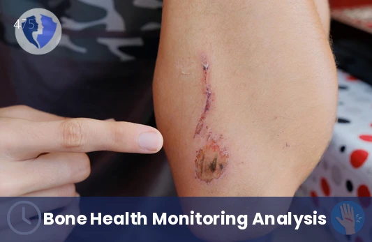 Tissue Health Indicator - Hydroxyproline Analysis (LC-MS/MS)