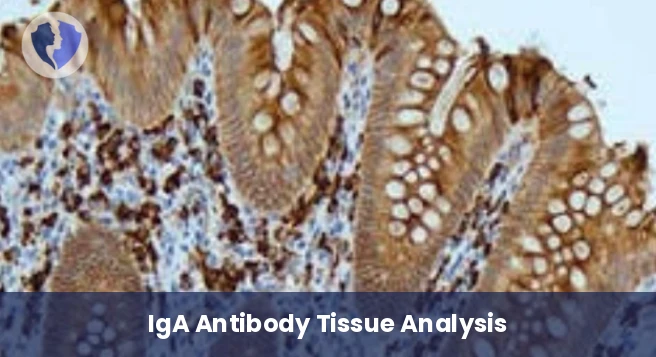 IgA Tissue Deposit Analysis - IgA Immunohistochemistry Test