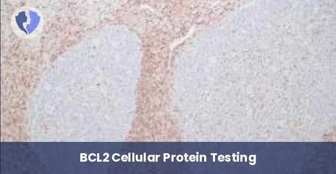 BCL2 Lymphoma Classification Test - Immunohistochemistry: BCL2 Test