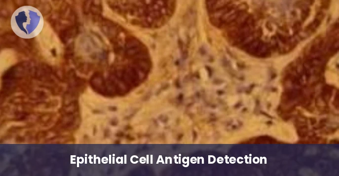 BerEP4 Cancer Cell Detection - Immunohistochemistry: BerEP4 Test