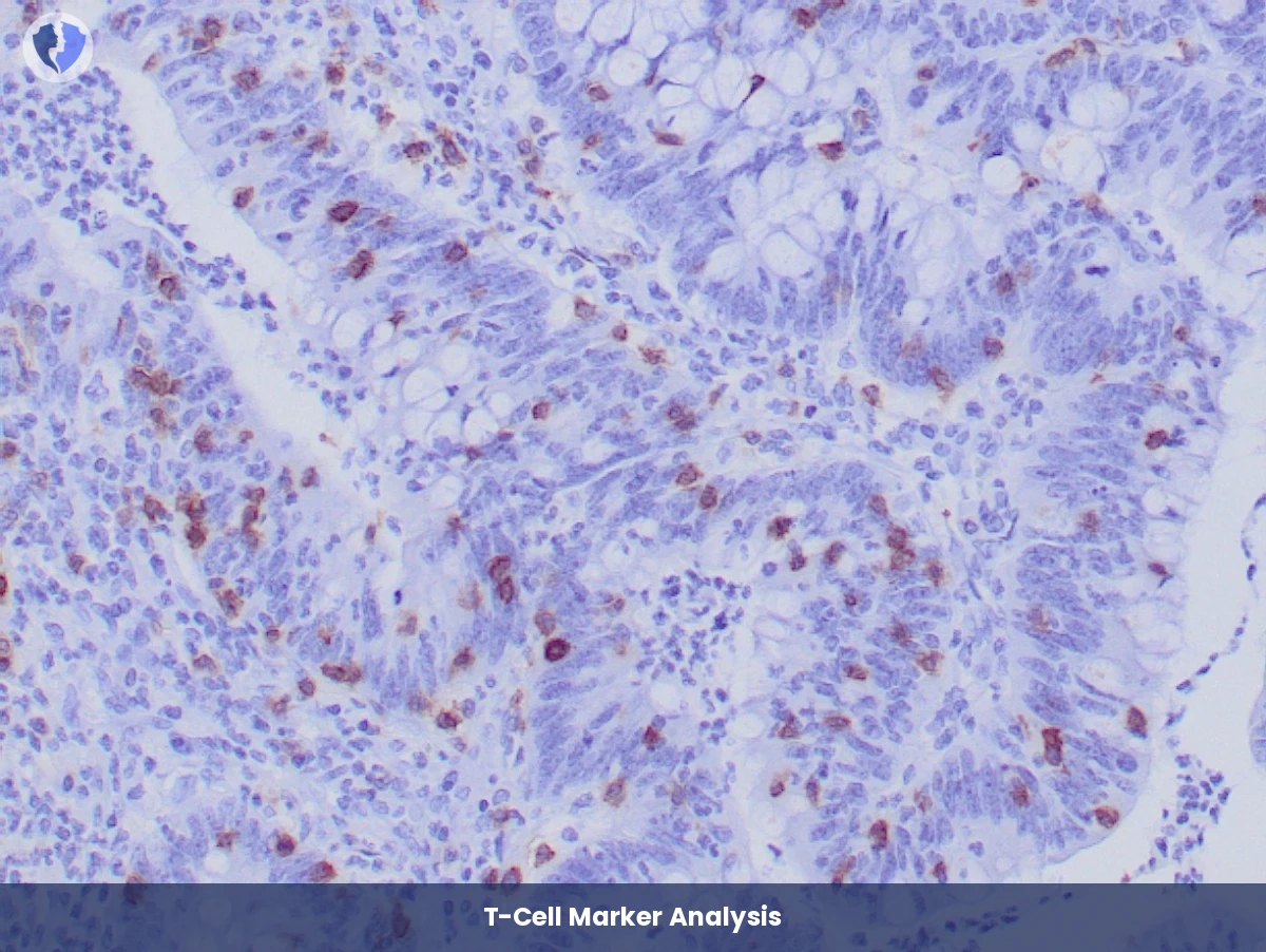 Intestinal Immune Disease Package - Immunohistochemistry: CD103 Diagnostic Package