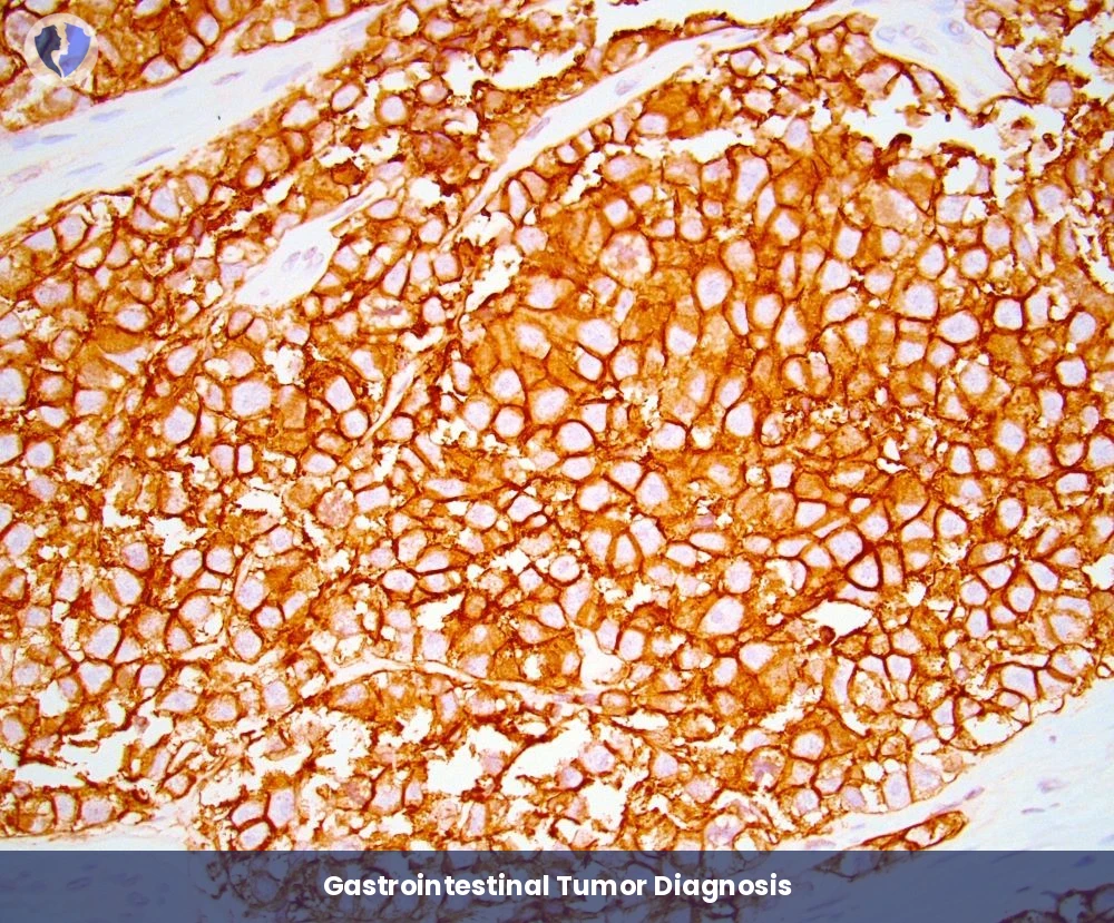 Gastrointestinal Sarcoma Package - Immunohistochemistry: CD117 Diagnostic Package