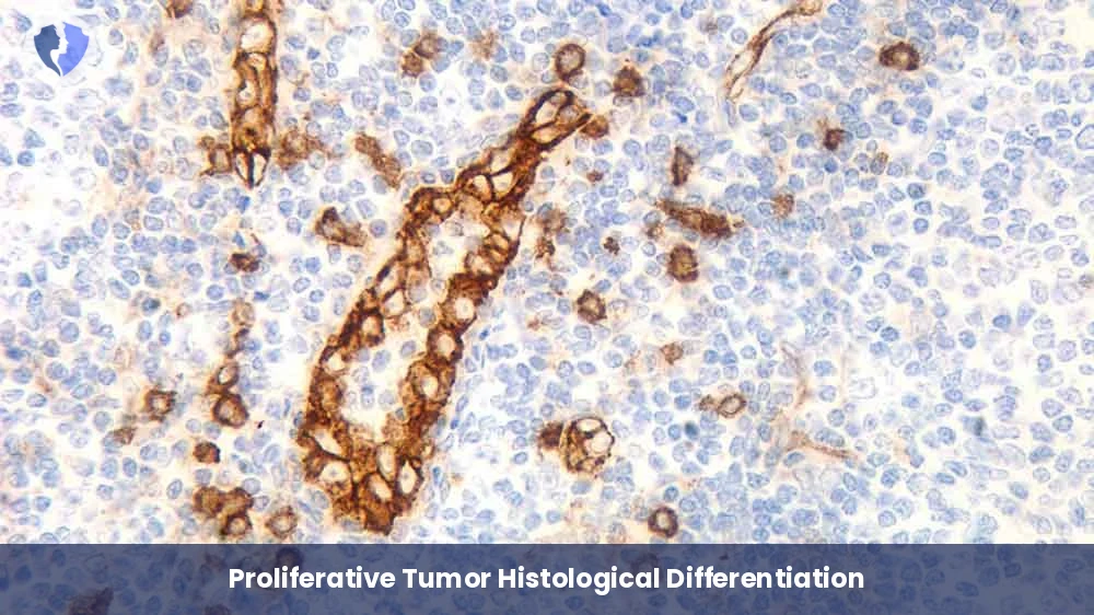 Blood & Lymphoid Tumor Package - Immunohistochemistry: CD123 Diagnostic Package