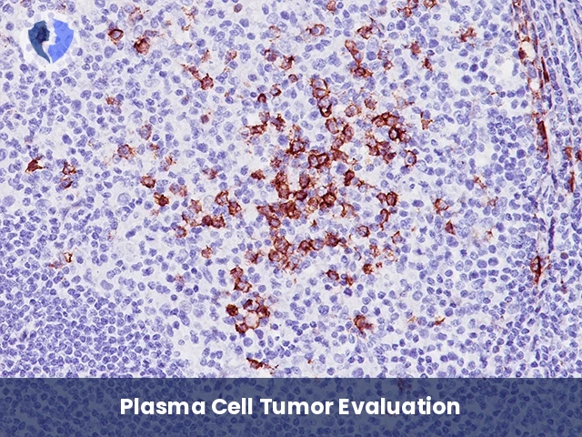 Myeloma & Plasma Disorder Package - Immunohistochemistry: CD138 Diagnostic Package