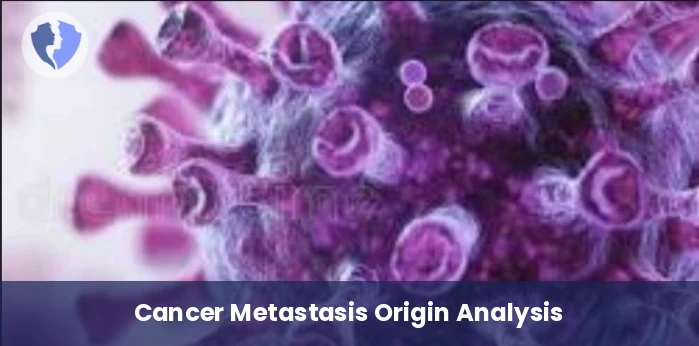 Metastatic Tumor Origin Test - Immunohistochemistry (IHC): CDX2