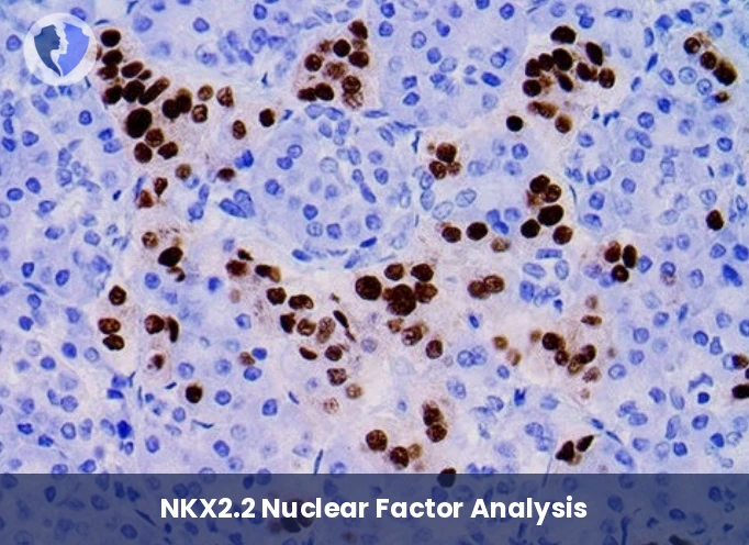 Bone and Soft Tissue Diagnosis - Immunohistochemistry (IHC) for NKX2.2