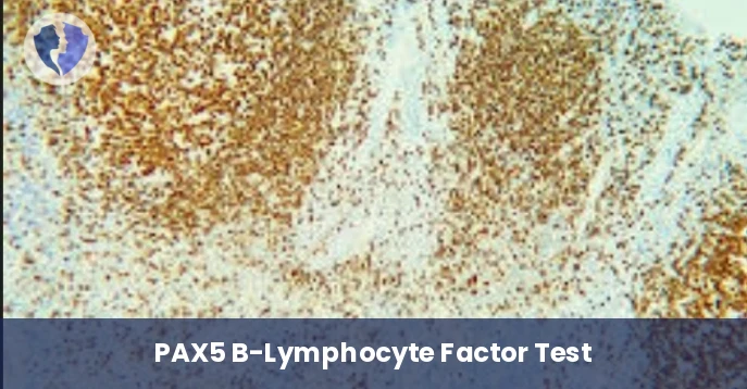 PAX5 Lymphoma Marker Test - Immunohistochemistry (IHC) for PAX5