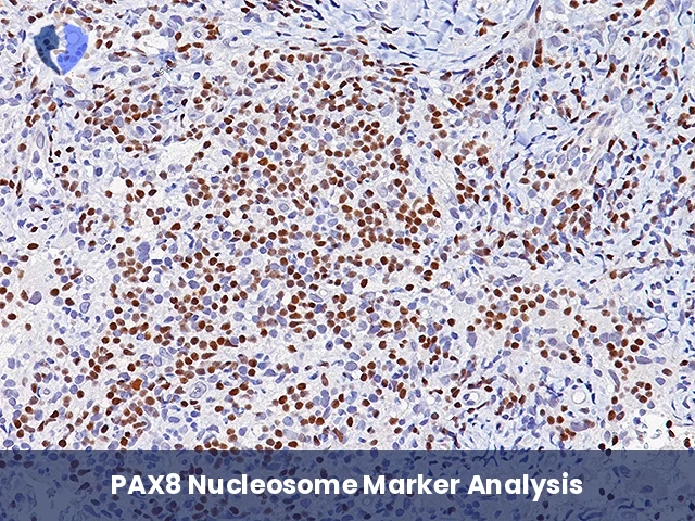 PAX8 Tumor Origin Test - Immunohistochemistry (IHC) for PAX8