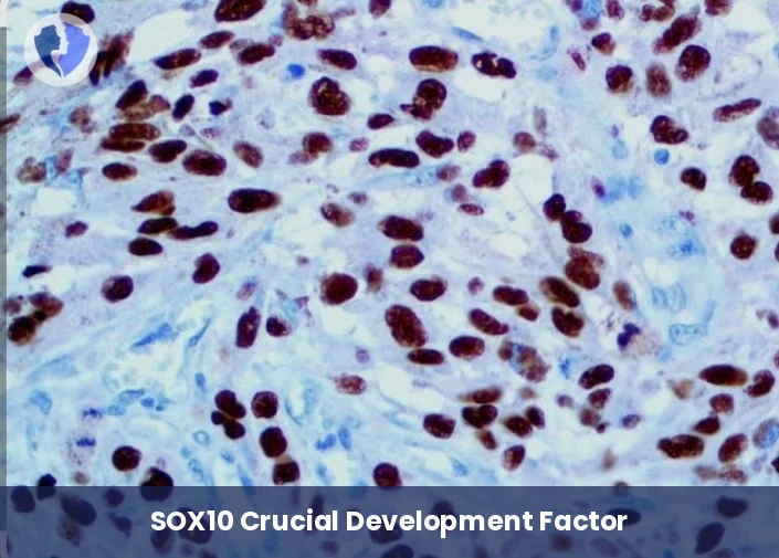 Skin and Nerve Tumor Screening - Immunohistochemistry (IHC) for SOX10