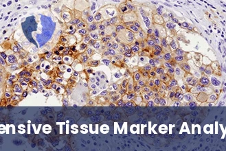 Dual Biomarker Interpretive Analysis - Immunohistochemistry (IHC) Interpretation and Consultation (2 Markers)