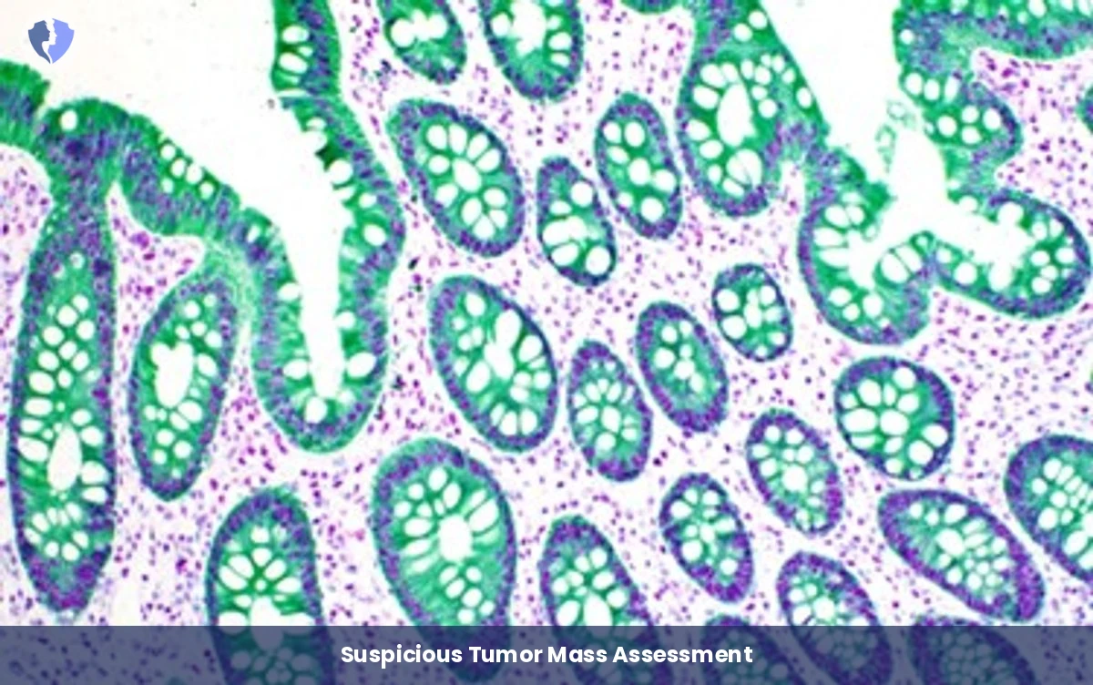 Determining Tumor Biological Biotype - Immunohistochemistry (IHC) Interpretation and Consultation (3 Markers)
