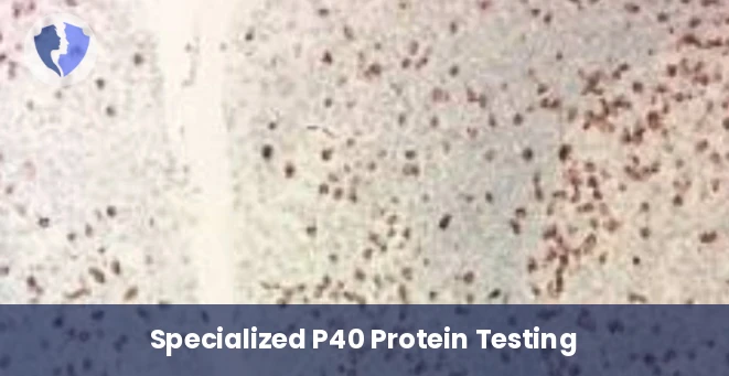 P40 Test for Lung Cancer - Immunohistochemistry: P40