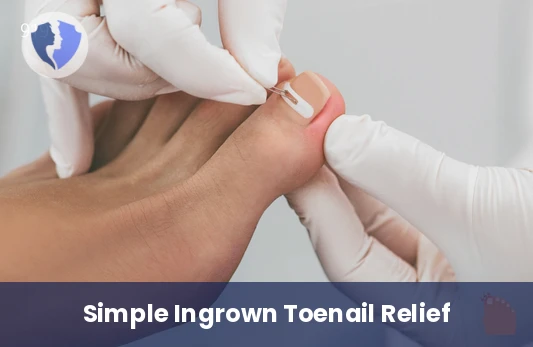 Ingrown Toenail Removal