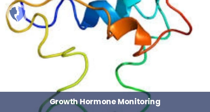 Growth Factor (IGF-1) Test - Insulin-like Growth Factor 1 (IGF-1) Test