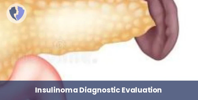 Insulinoma Diagnostic Test - Insulinoma Associated Antibodies Test