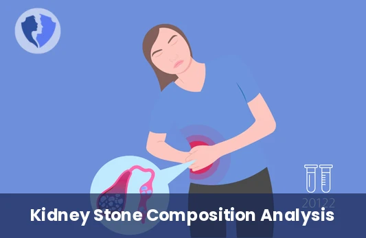 Kidney Stone Analysis