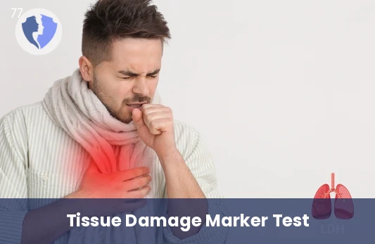 LDH Enzyme Test - Lactate Dehydrogenase (LDH) Test