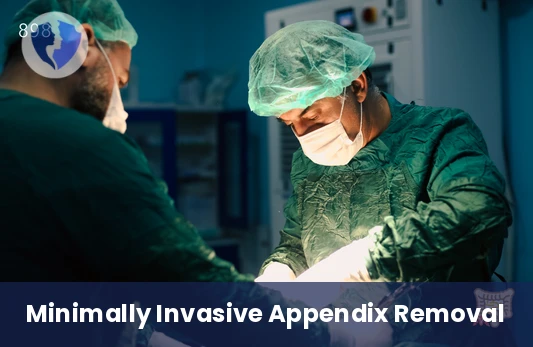 Laparoscopic Appendectomy