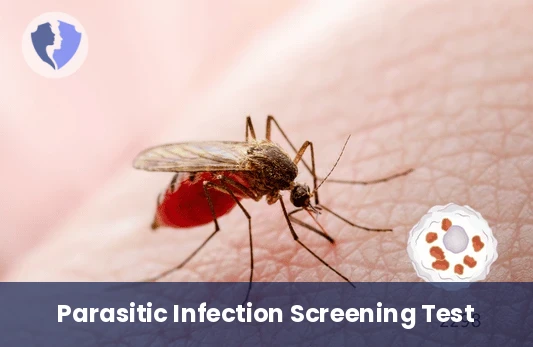 Leishmania Antibody Test