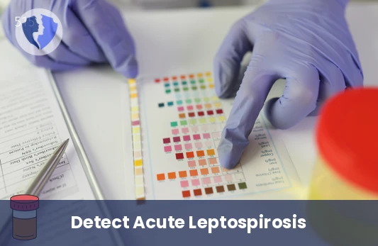 Detect Active Leptospira Infection - Leptospiral IgM Antibody Test