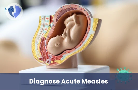 Detect Early Measles Infection - Measles IgM Antibody Test