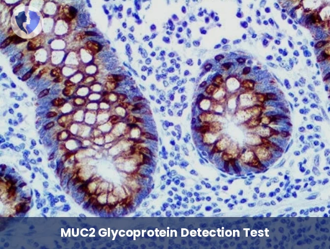 MUC2 Mucinous Cancer Test - MUC2 Immunohistochemistry Test