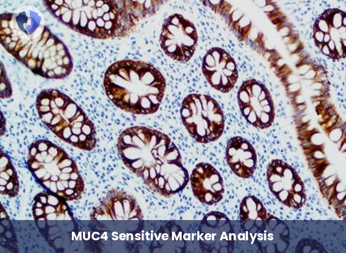 MUC4 Rare Tumor Diagnostic Test - MUC4 Immunohistochemistry Test