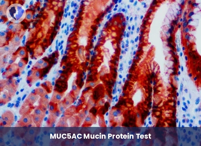 MUC5AC Gastric & Pancreatic Test - MUC5AC Immunohistochemistry Test