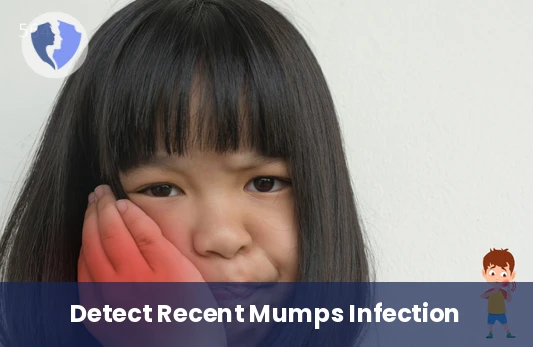 Mumps Immunity IgA Test - Mumps Virus IgA Antibody Test