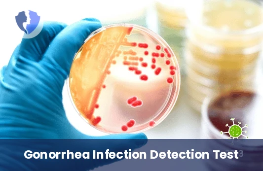 Rapid Gonorrhea Smear Test - Neisseria Gonorrhoeae Smear