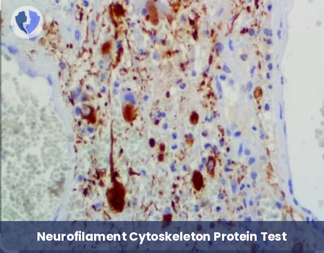 Nerve Cell Integrity Assessment - Neurofilament Immunohistochemistry Test