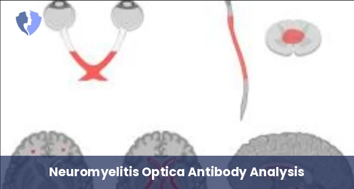 Neuromyelitis Optica Diagnostic Test - Neuromyelitis Optica (NMO) IgG Antibody Test