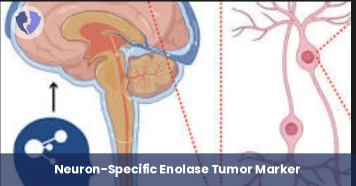 Neuronal Tumor and Injury Marker - Neuron-Specific Enolase (NSE) Test