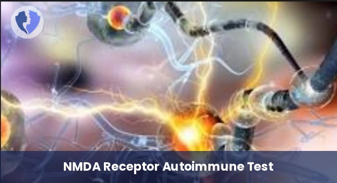 Autoimmune Encephalitis Test - NMDA Receptor Antibody Test