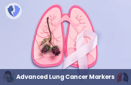 Early Lung Cancer Screening - Pan Lung Cancer Panel