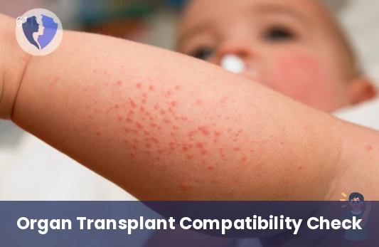 Immune Readiness for Transplant - Panel Reactive Antibodies (PRA) Test