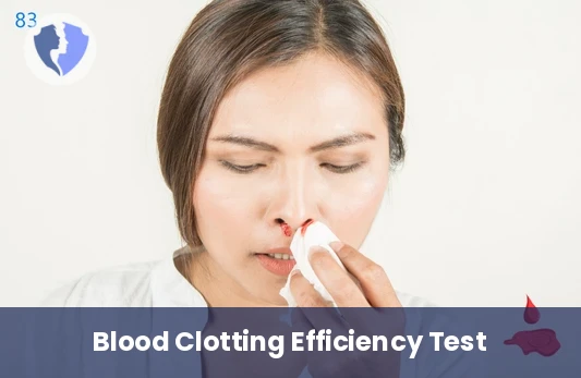 Blood Clotting Efficiency Test - Partial Thromboplastin Time (PTT) Test