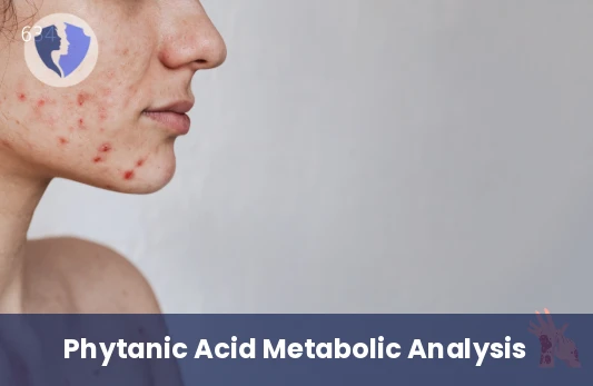 Phytanic Acid Test