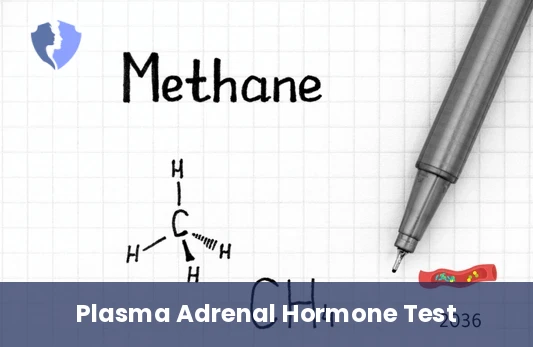 Plasma Metanephrines Test - Plasma Metanephrine and Normetanephrine Test