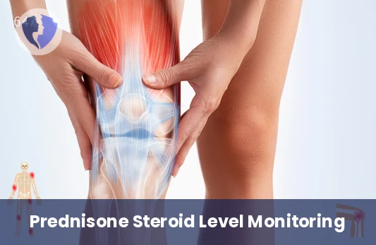 Monitor Therapeutic Corticosteroid Levels - Prednisone or Prednisolone Level Test