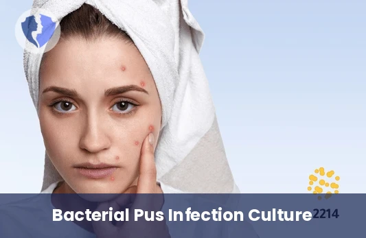 Pus Culture & Sensitivity - Pus Culture and Sensitivity