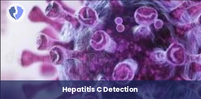 Hepatitis C RNA PCR Test - Qualitative Hepatitis C Virus (HCV) RNA PCR Test