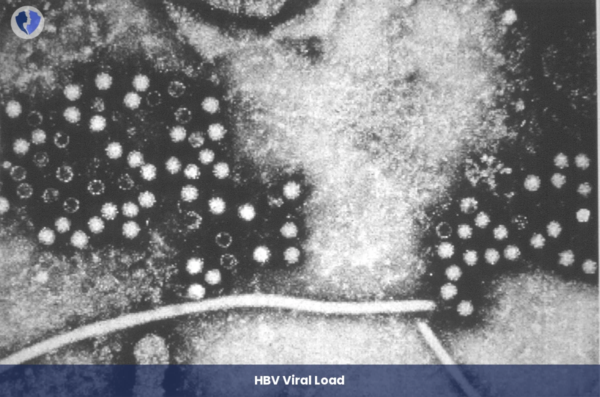 Hepatitis B Viral Load Test - Quantitative Hepatitis B Virus (HBV) DNA PCR Test